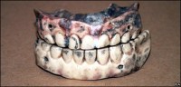 18th century porcelain dentures Image @CBBC