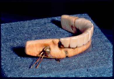 George Washington's dentures. Image @Samuel D. Harris National Museum of Dentistry, Baltimore