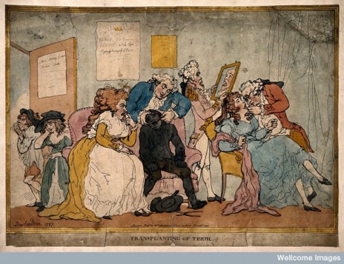 This print is by Thomas Rowlandson (1756-1827) and is dated 1787. It is a satirical comment upon the real practice of rich gentlemen and ladies of the 18th century paying for teeth to be pulled from poor children and transplanted in their gums. Image @Children and Youth in History